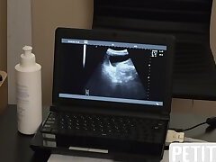 Petite twink fucked during ultra sound in doctor infirmary