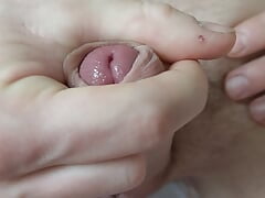 glans banded painfully with elastrator band cumming