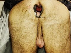 Anal speculum gape making sounds