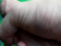 The man completed in his own foreskin