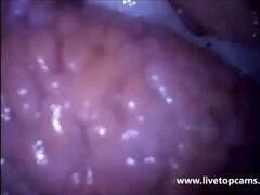 Verein, Extrem, Frau, Fetisch, Hd, Solo, Jungendliche (18+), Bizarr