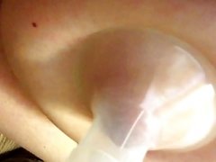Breastpump Induced Lactation