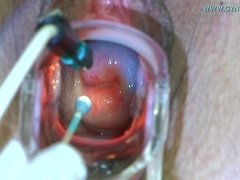 Enthousiasteling, Kont, Blond, Arts, Exam, Fetisj, Gynaecoloog, Inshuiven