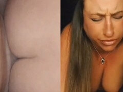 Accidente, Anal, Extremo, Dolor