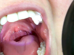 コンピレーション, フェティッシュ