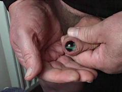 24 marbles in foreskin