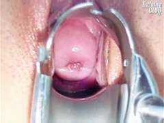 Bondage domination sadisme masochisme, Médecin, Exam, Gyneco