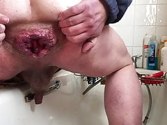 Monday afternoon anal gaping - 1 of 3