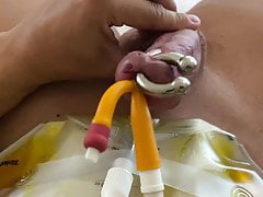 Cumming with catheter on.