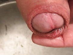 Piss and foreskin