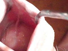 Creamy foreskin in sunlight