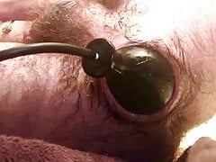 Self fisting prolapse and Inflation anal toy