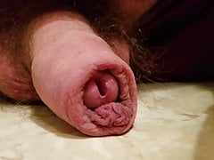 Getting hard, rolling skin