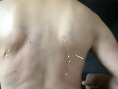 neddles pain