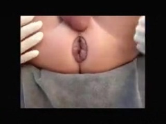 Object Anal Insertion - Anus Dilation
