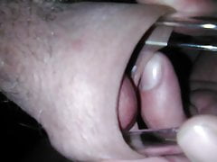 speculum streach