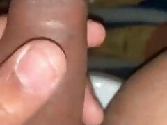 smegma check