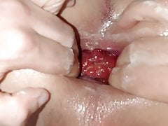 Anal stretching