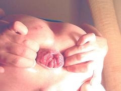 butthole preparing the prolapse