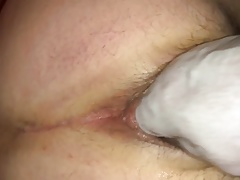 Ass fisting