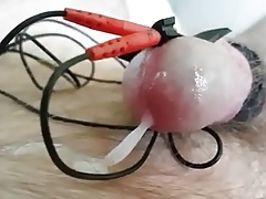 Estim Electro Stimulation