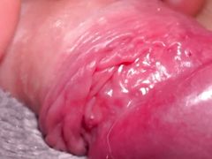 Macro Skin on My Dick