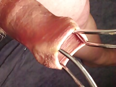 Sunday evening foreskin