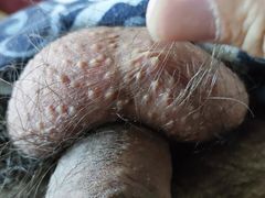My Hairy Body and Dick