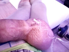 Filling up with 1liter glucose