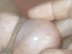 Split head and balls