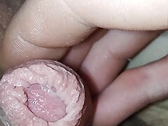 teen with gonorrhea infected small dick masturbates and shows close-up discharge