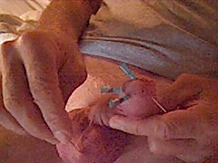 Needle play