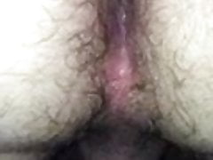 Hairy Hole