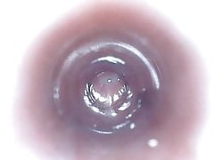 Inside the Pee-hole