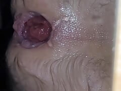 Small prolapse