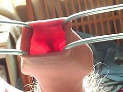 Foreskin in sunlight