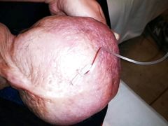 Growing with Glucose