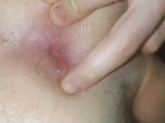 asshole after heavy anal