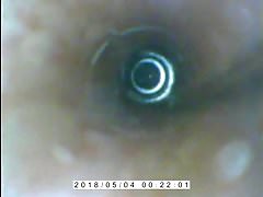 endoscope peehole cumflow