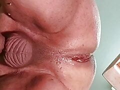 First time inserted plug cm. 7.5