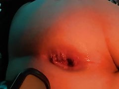 Ass gape