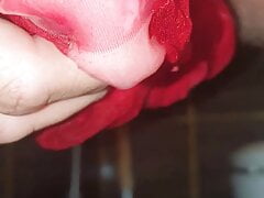 Stocking cum eruption