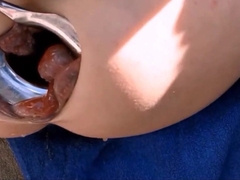 Extreme Anal Fisting for My Loose Sloppy Asshole0000