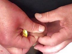 Chocolate coins (11) in foreskin
