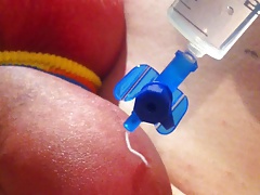 foreskin saline inflation